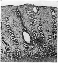 Low power view of implantation site