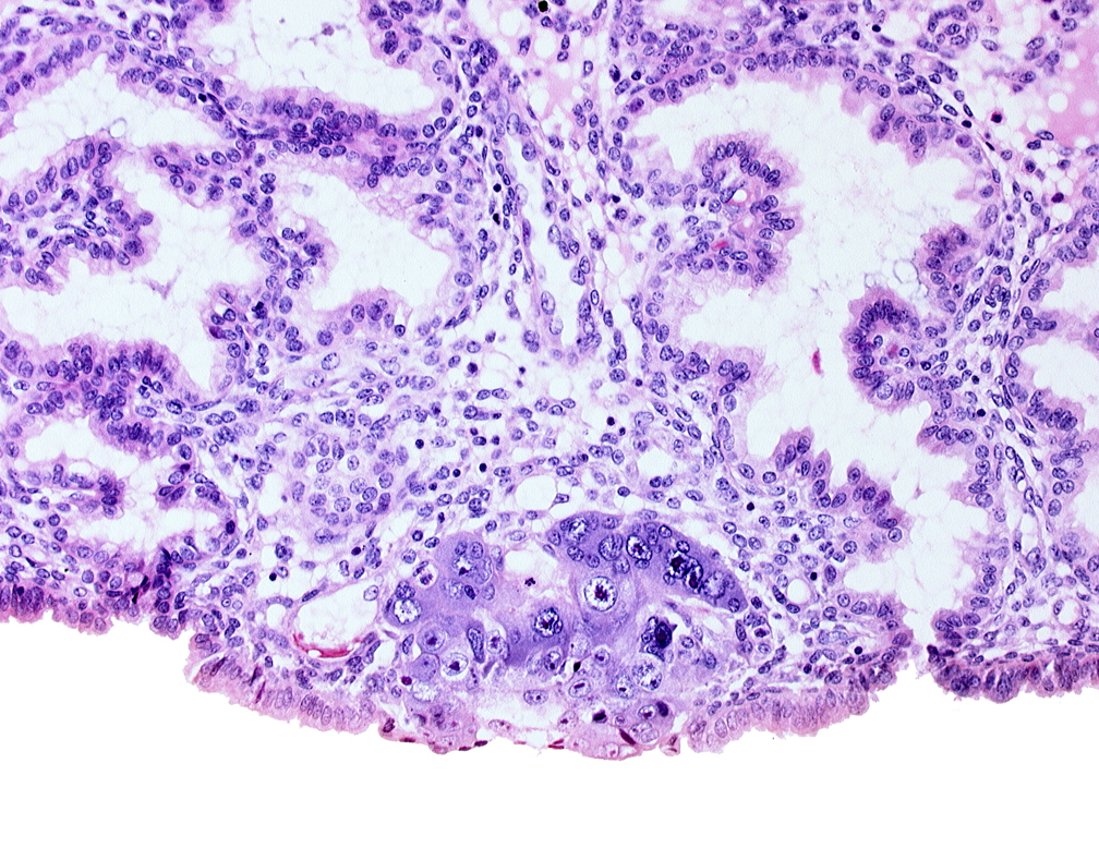 blastocystic cavity (blastocoele), endometrial sinusoid, extra-embryonic mesoblast, membranous trophoblast at abembryonic pole, mouth of adjacent endometrial gland, syncytiotrophoblastic mass