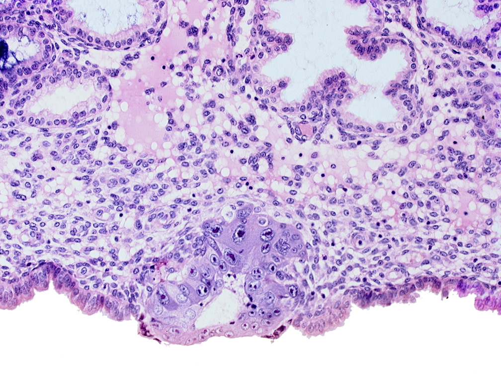 blastocystic cavity (blastocoele), cytotrophoblast, syncytiotrophoblast