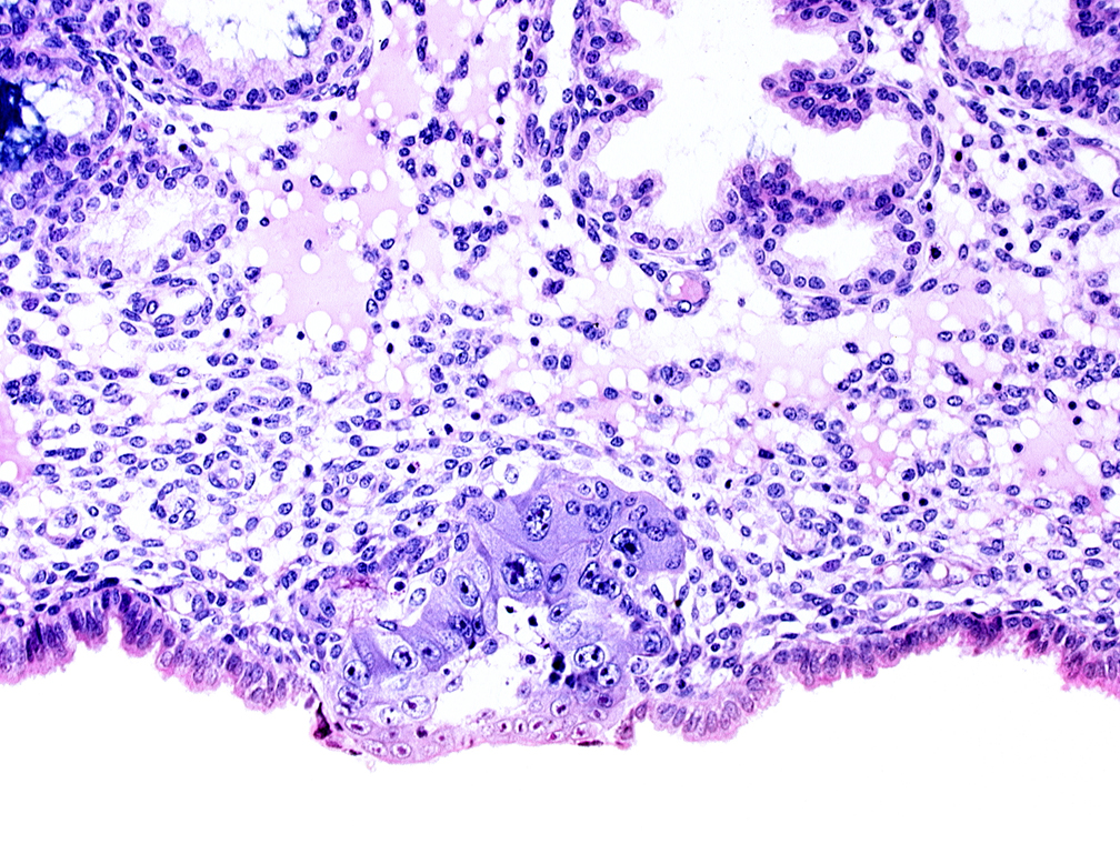 blastocystic cavity (blastocoele), cytotrophoblast, syncytiotrophoblast