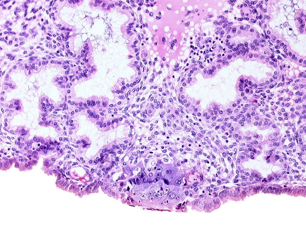 cytotrophoblast, endometrial epithelium, endometrial sinusoid, syncytiotrophoblast