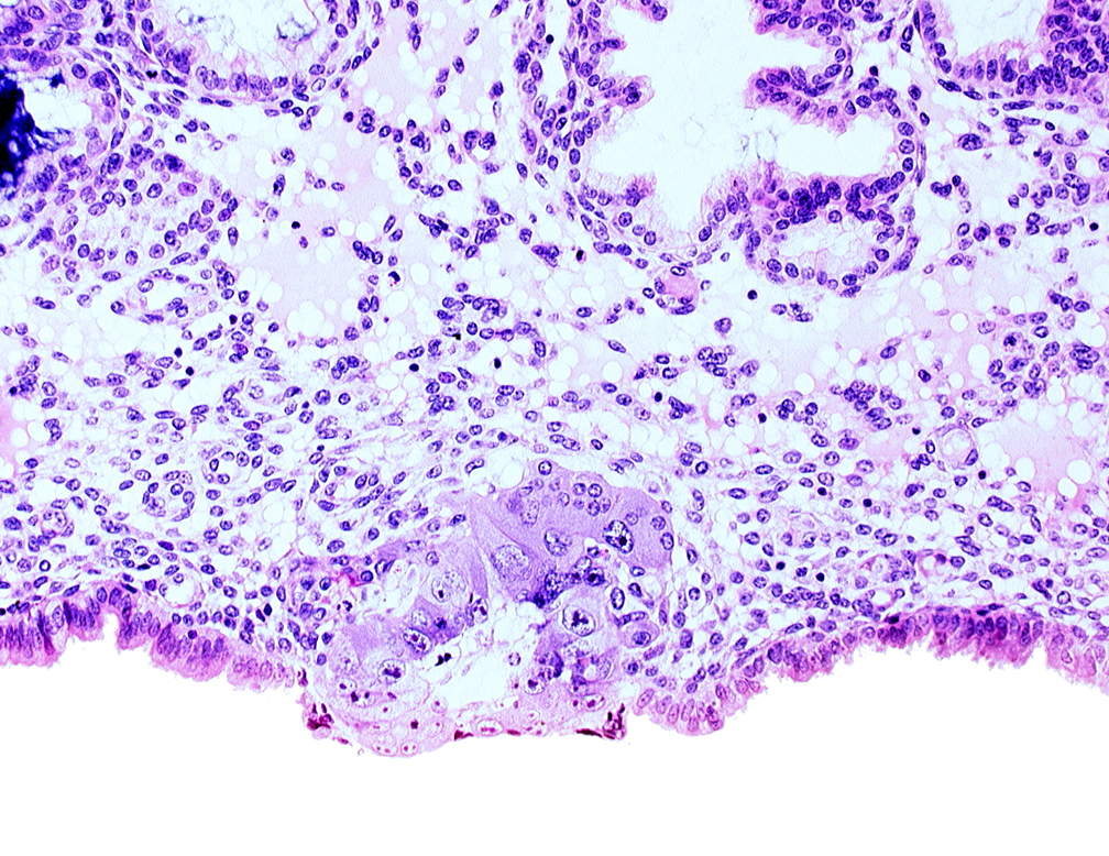 blastocystic cavity (blastocoele), cytotrophoblast, solid syncytiotrophoblast