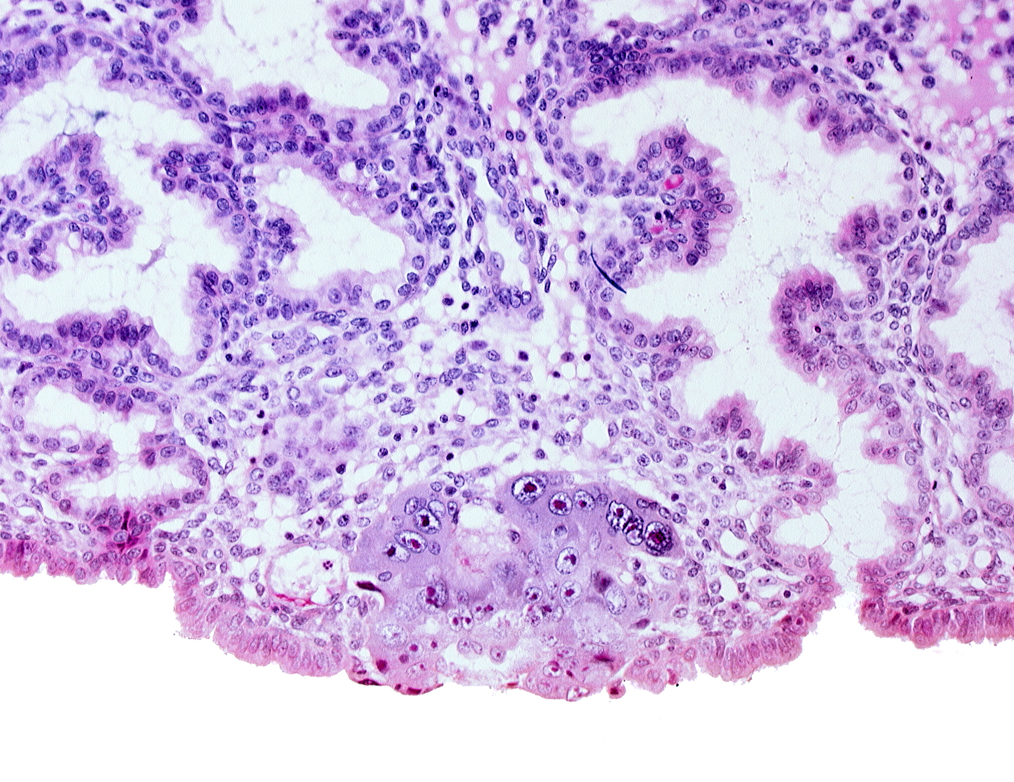 amnioblast(s), blastocystic cavity (blastocoele), edge of amniotic (tropho-epiblastic) cavity, epiblast, hypoblast, membranous trophoblast at abembryonic pole, syncytiotrophoblastic mass
