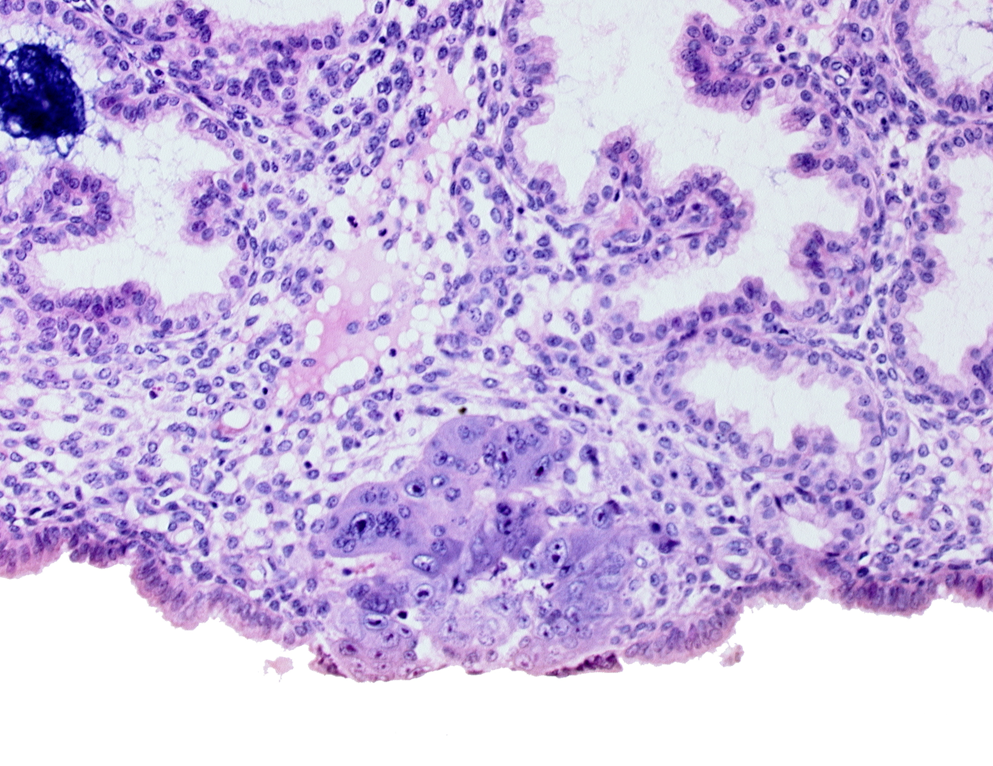 blastocystic cavity (blastocoele), edge of amniotic cavity, epiblast, hypoblast, membranous trophoblast at abembryonic pole, syncytiotrophoblast