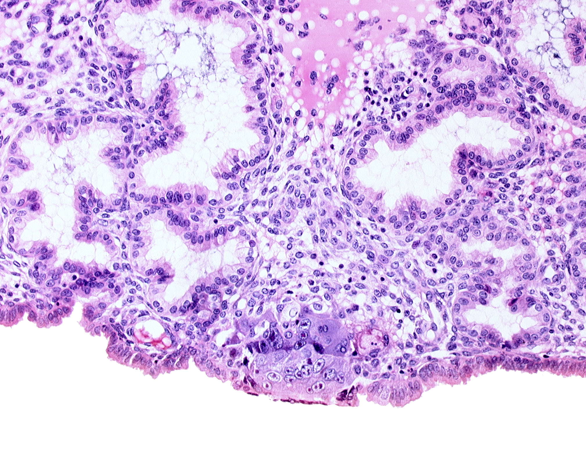 cytotrophoblast, endometrial epithelium, endometrial sinusoid, syncytiotrophoblast