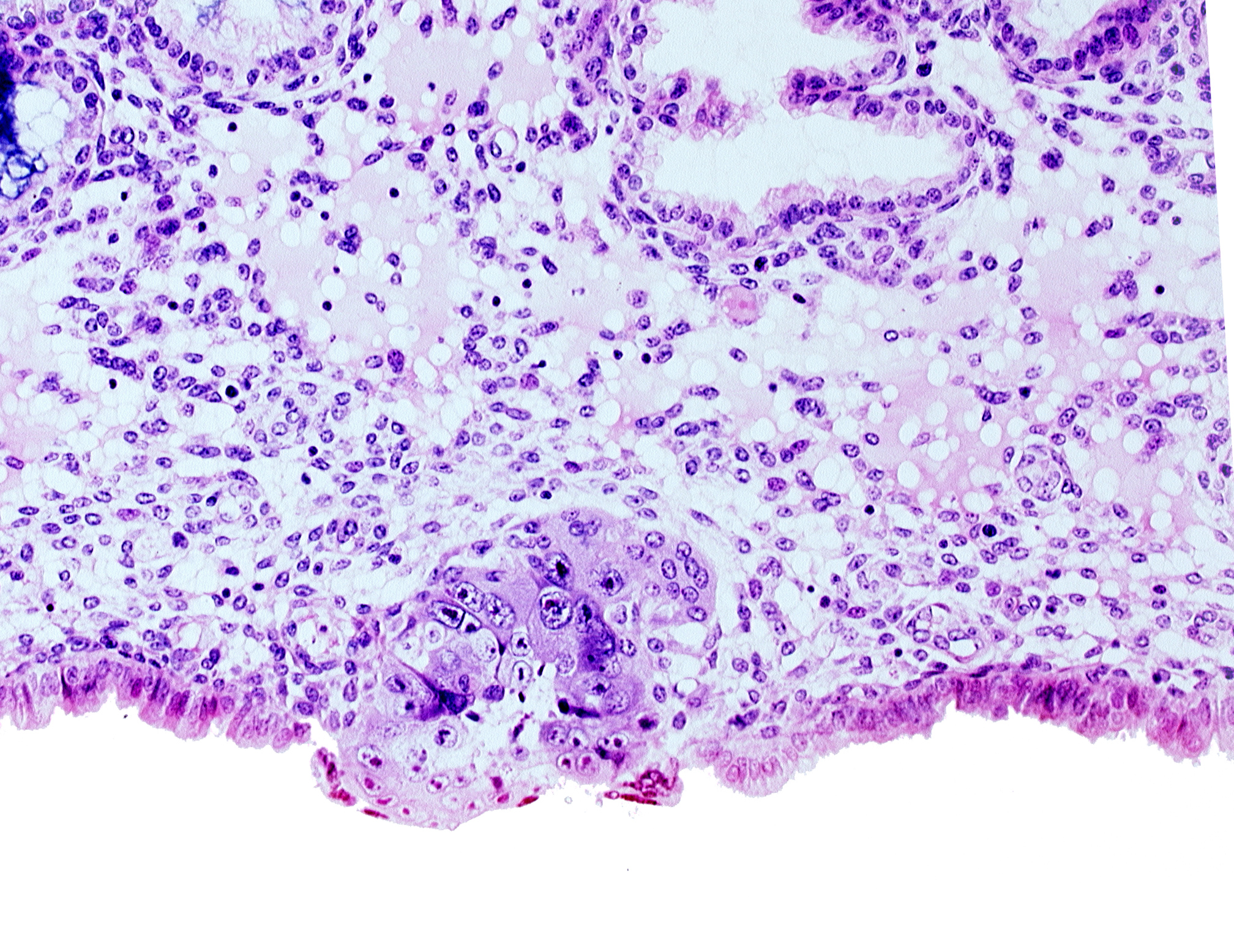 cytotrophoblast, edge of blastocystic cavity (blastocoele), solid syncytiotrophoblast