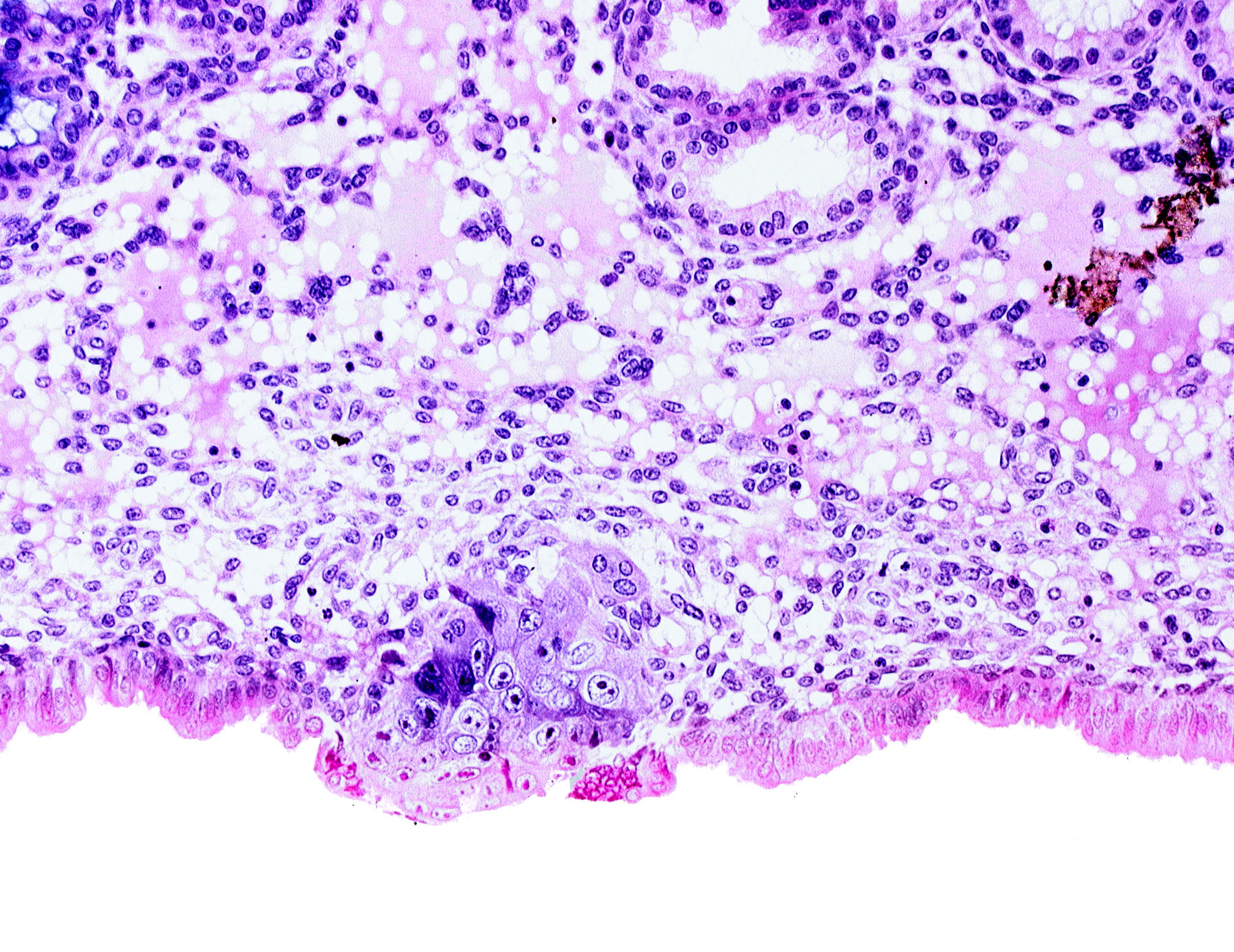 cytotrophoblast, edematous endometrial stroma (decidua), endometrial epithelium, endometrial sinusoid, syncytiotrophoblast, uterine cavity