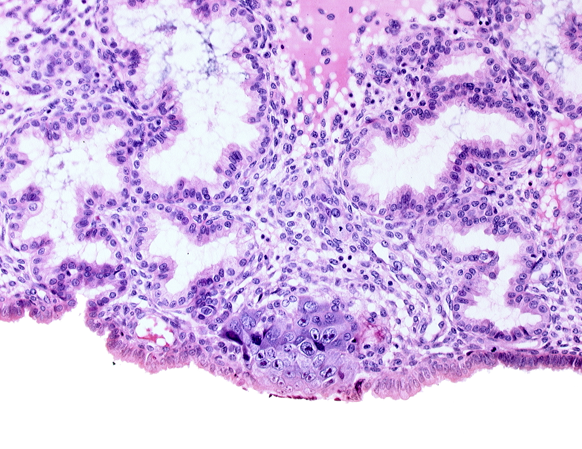 cytotrophoblast, endometrial epithelium, syncytiotrophoblast, syncytiotrophoblast / decidua interface, uterine cavity