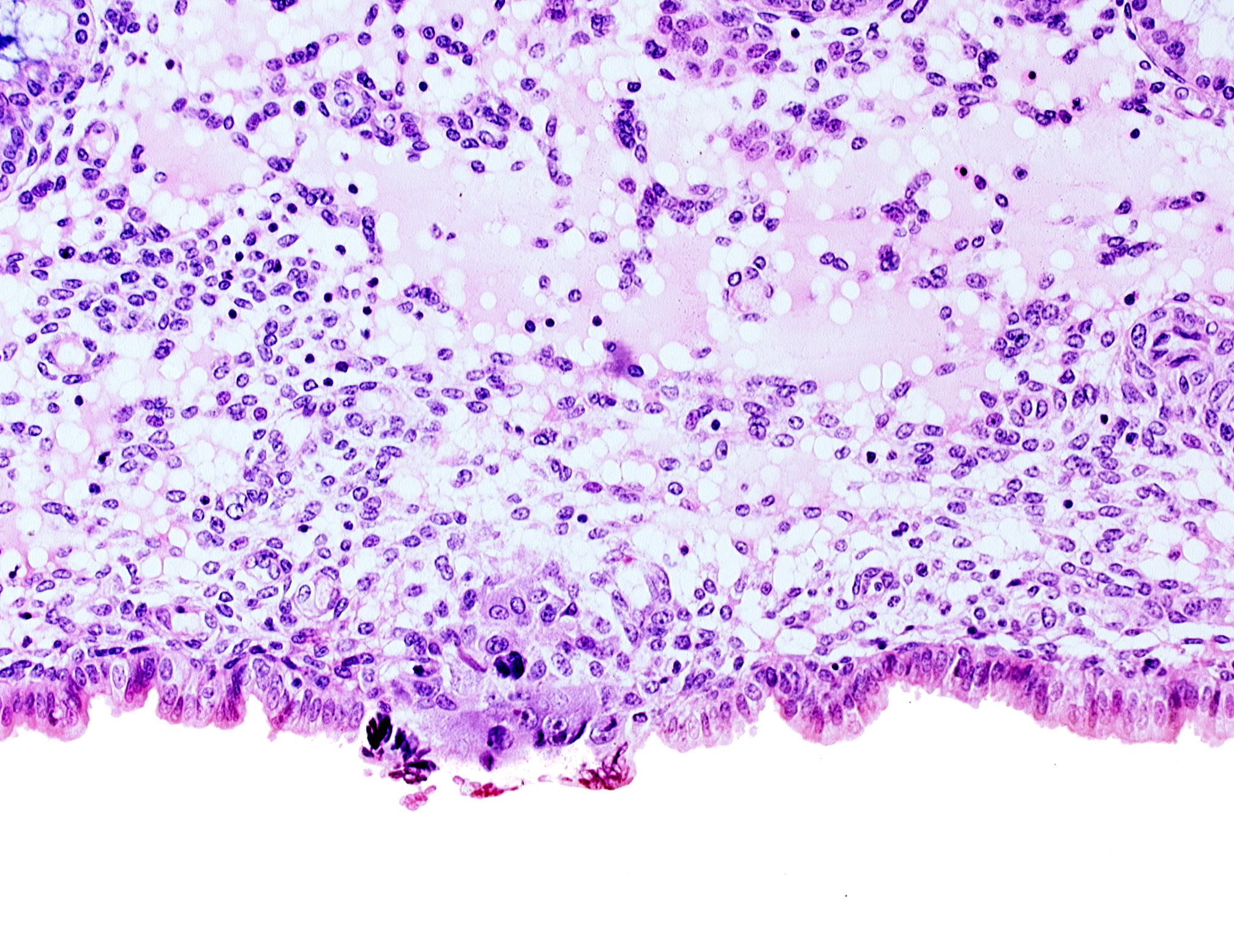 cytotrophoblast, edge of membranous trophoblast at abembryonic pole, uterine cavity