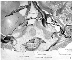 Drawing of reconstructed embryo