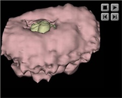 Trophoblast