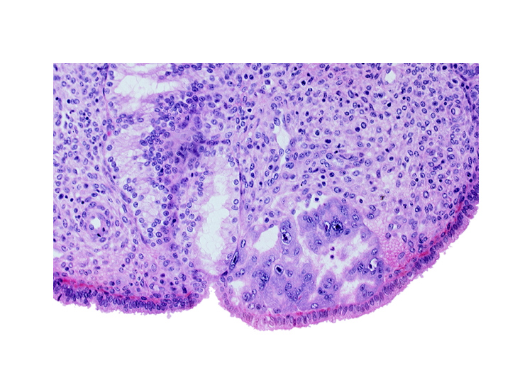 endometrial sinusoid, intact endometrial epithelium, mouth of endometrial gland, syncytiotrophoblast