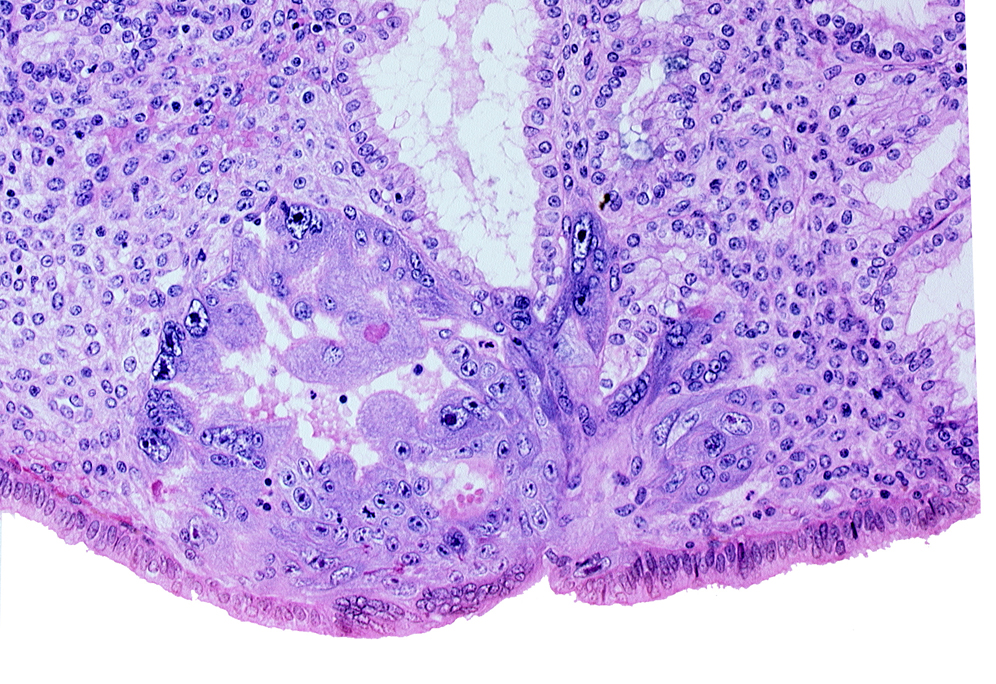 edematous endometrial stroma (decidua), endometrial epithelium, lumen of endometrial gland, maternal blood cells in intercommunicating lacunae, primary umbilical vesicle cavity, syncytiotrophoblast