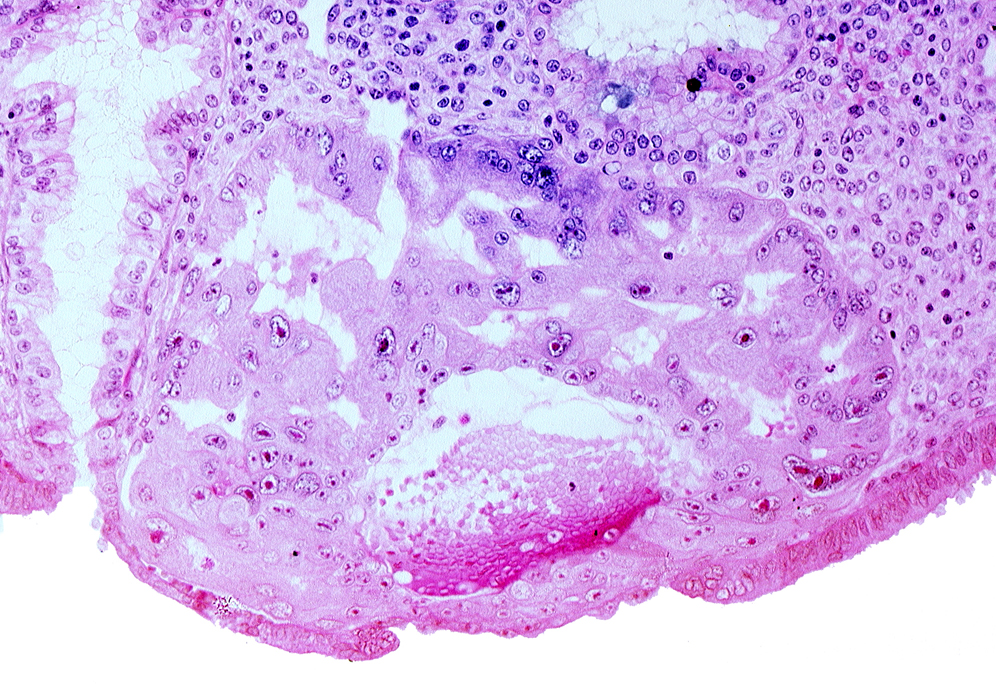 lumen of endometrial gland, maternal blood cells in primary umbilical vesicle cavity, mouth of endometrial gland