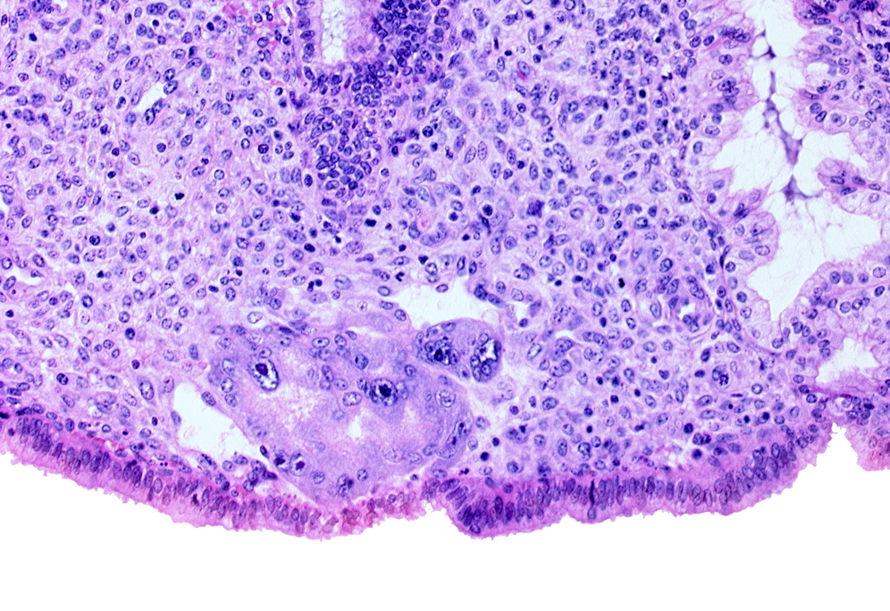 edge of trophoblast lacuna(e), endometrial sinusoid, syncytiotrophoblast