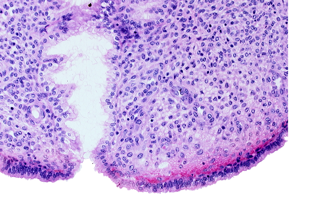 endometrial sinusoid, intact endometrial epithelium, uterine cavity