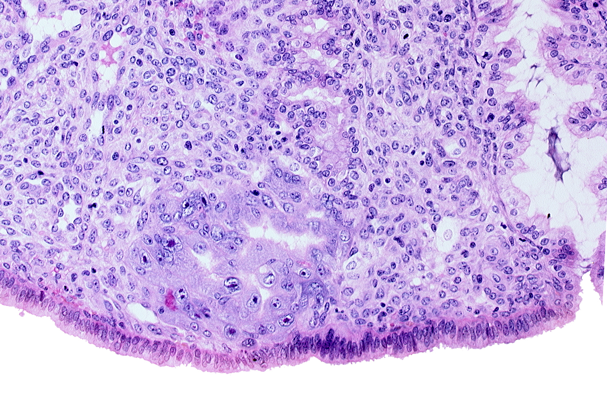 endometrial sinusoid, intact endometrial epithelium, syncytiotrophoblast, trophoblast lacunae, uterine cavity