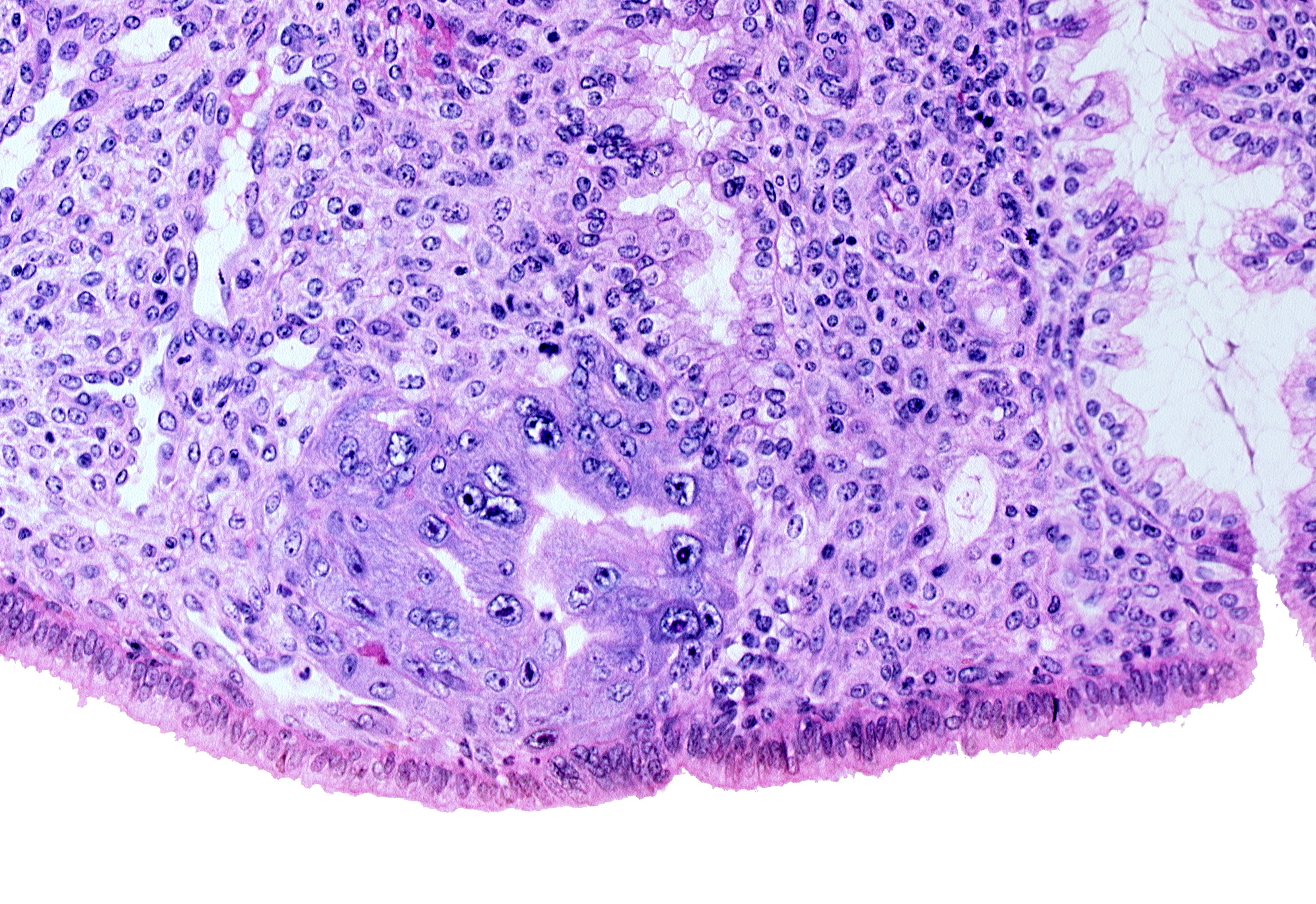 endometrial sinusoid, intact endometrial epithelium, lumen of endometrial gland, trophoblast lacunae, uterine cavity