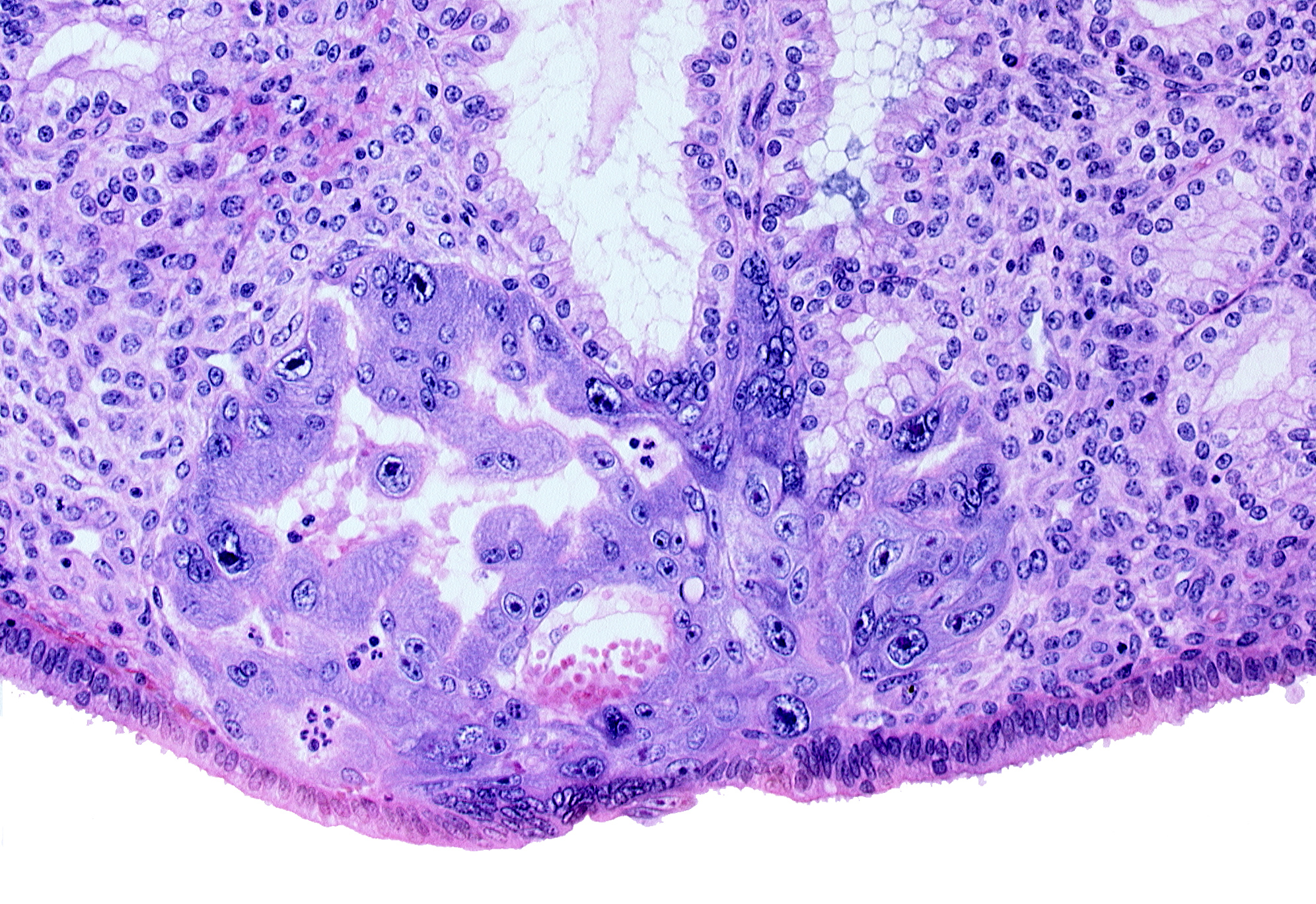 endometrial epithelium, endometrial stroma (decidua), intercommunicating lacunae, lumen of endometrial gland, maternal blood cells in primary umbilical vesicle cavity, previllus clump of cytotrophoblast, syncytiotrophoblast