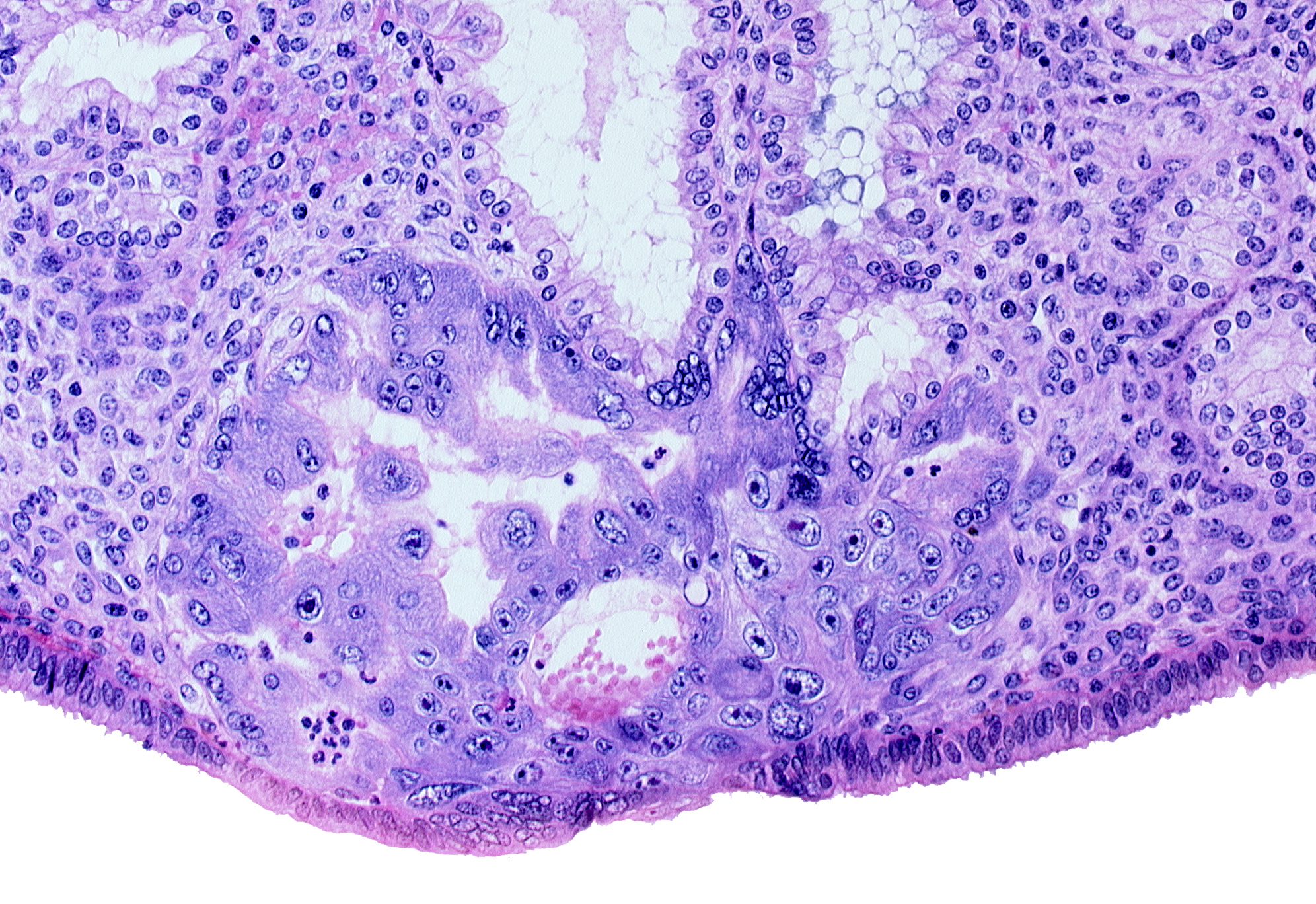 endometrial epithelium, lumen of endometrial gland, primary umbilical vesicle cavity, uterine cavity