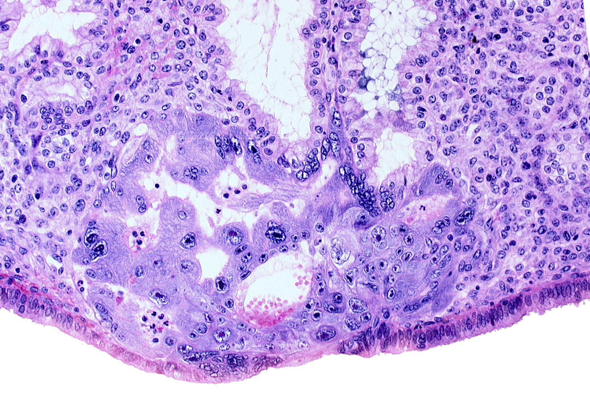cytotrophoblast, disrupted endometrial gland cells, endometrial epithelium, lumen of endometrial gland, primary umbilical vesicle cavity, syncytiotrophoblast, uterine cavity