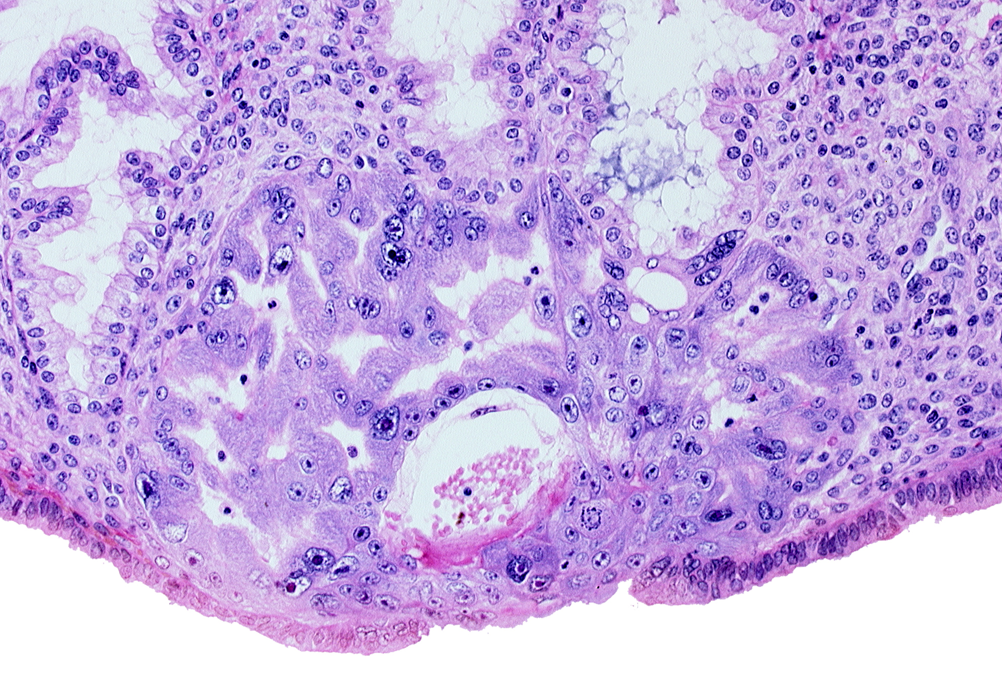 extra-embryonic mesoblast, intact endometrial epithelium, lumen of endometrial gland, maternal blood cells in primary umbilical vesicle cavity, primary umbilical vesicle cavity