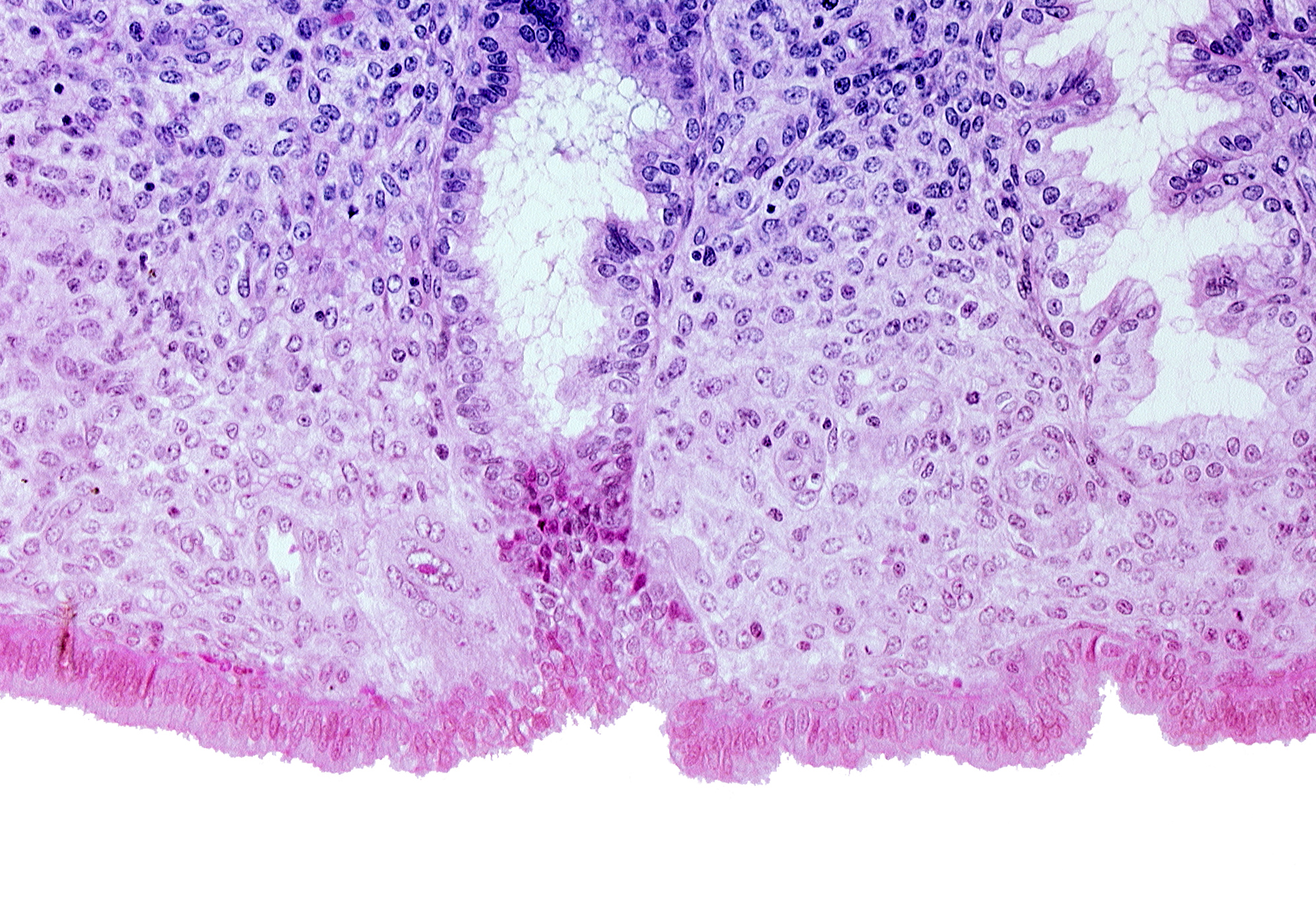 edematous endometrial stroma (decidua), edge of syncytiotrophoblast, intact endometrial epithelium, lumen of endometrial gland