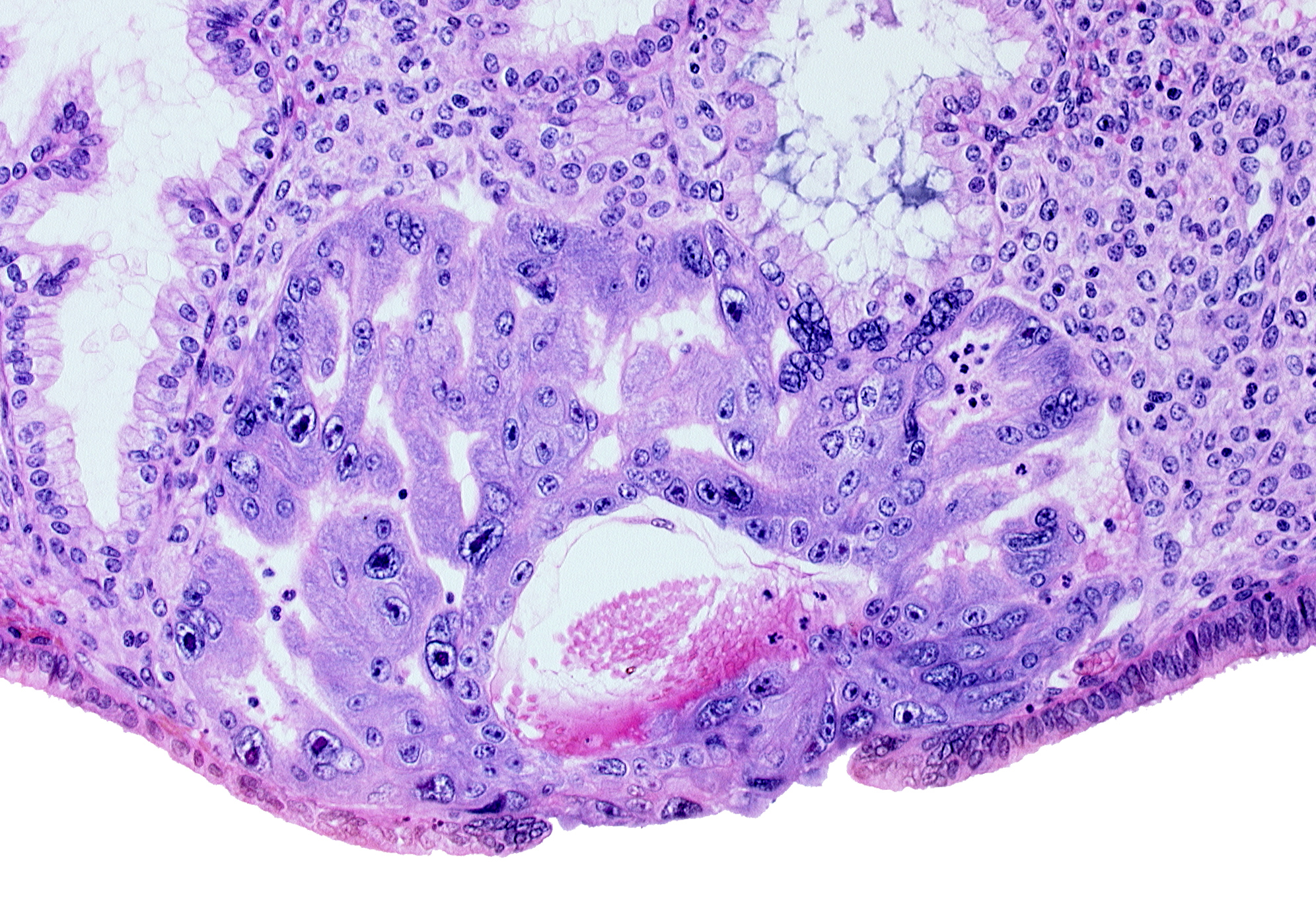 extra-embryonic mesoblast, intercommunicating lacunae, lumen of endometrial gland, maternal blood cells in primary umbilical vesicle cavity, primary umbilical vesicle cavity