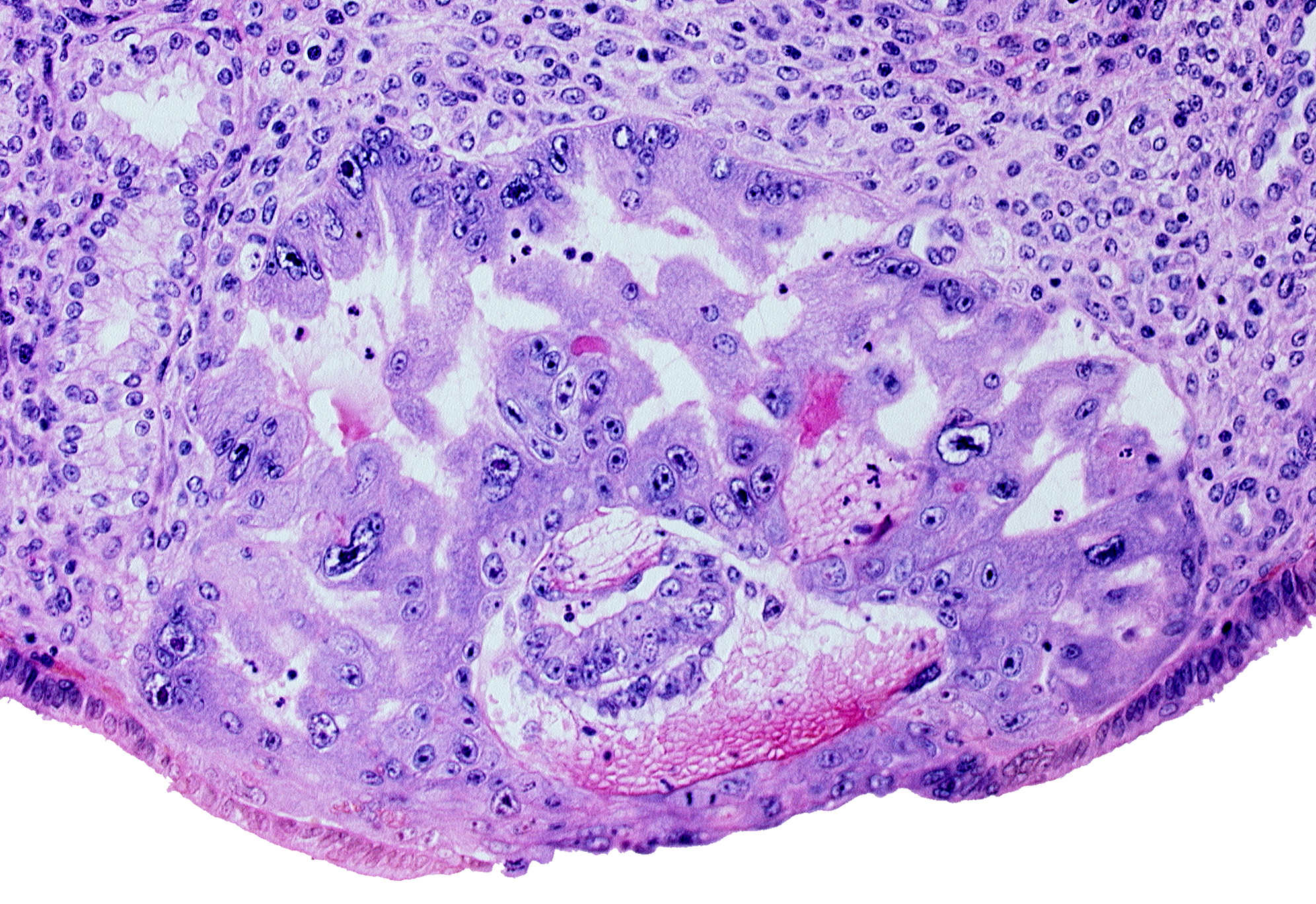 amniotic cavity, epiblast, hypoblast, maternal blood cells in primary umbilical vesicle cavity