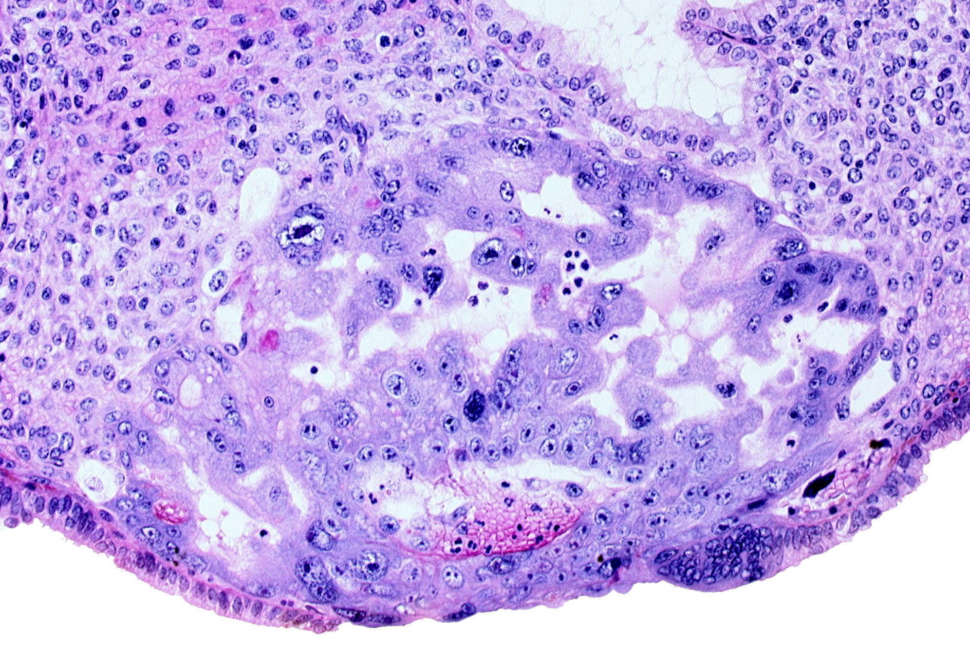 cytotrophoblast, maternal blood cells in primary umbilical vesicle cavity, previllus clump of cytotrophoblast, syncytiotrophoblast