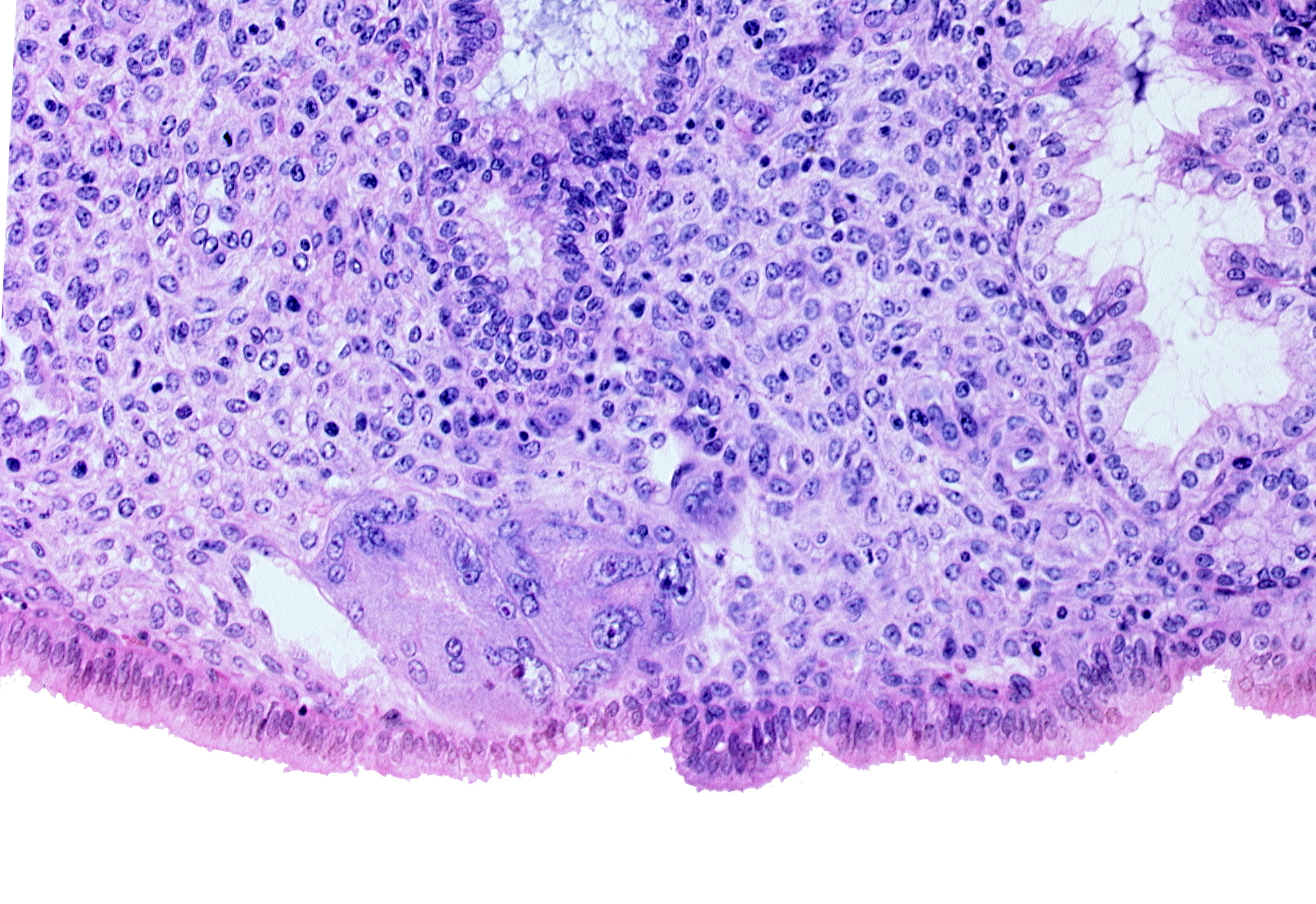 endometrial gland, endometrial sinusoid, intact endometrial epithelium, syncytiotrophoblast, uterine cavity