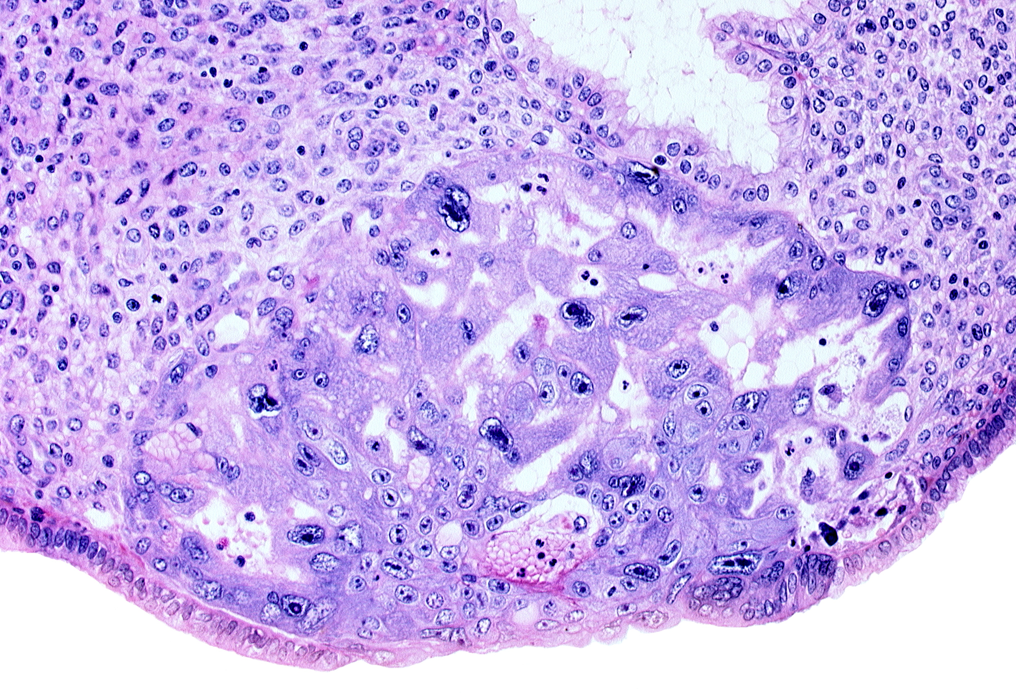 intercommunicating lacunae, uterine cavity