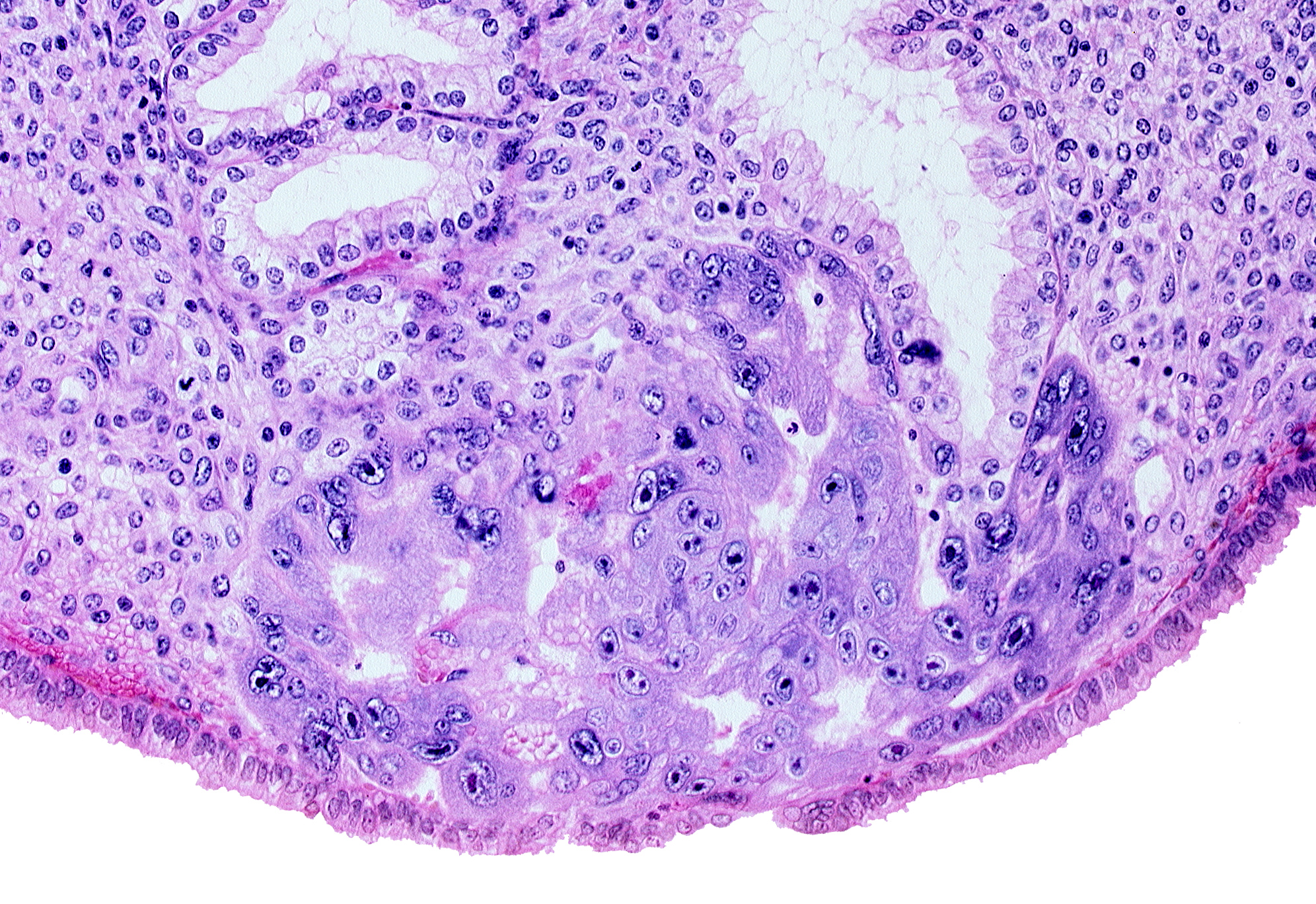disrupted endometrial epithelium, endometrial epithelium, endometrial gland, intercommunicating lacunae, syncytiotrophoblast