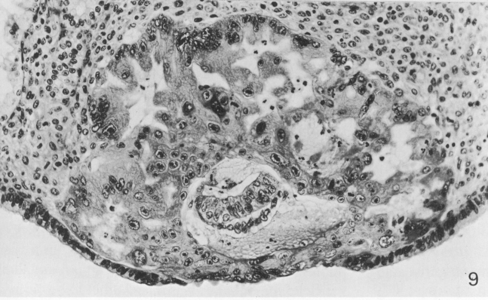 Section through middle of embryo