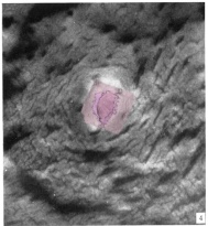 Surface view of implantation site with 3D reconstruction
