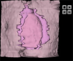 Implantation Site