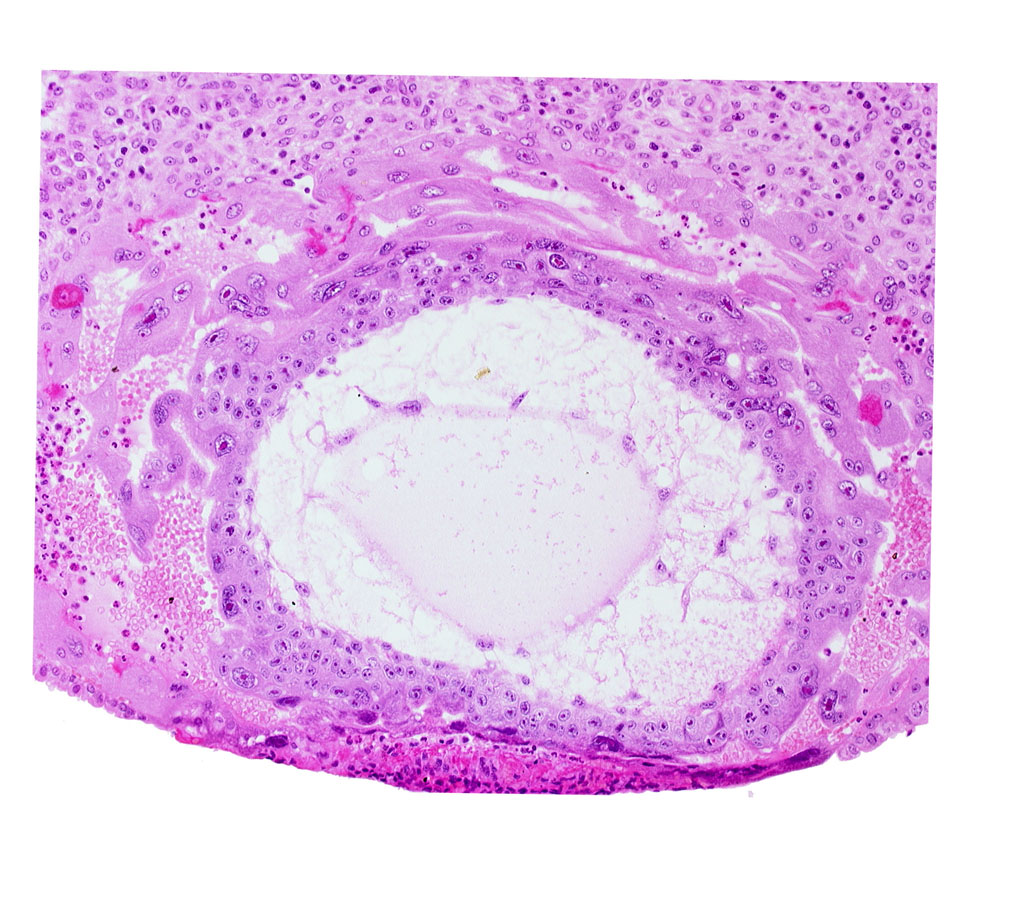 chorionic cavity, definitive exocoelomic (Heuser's) membrane, extra-embryonic mesoblast, syncytiotrophoblast, uterine cavity