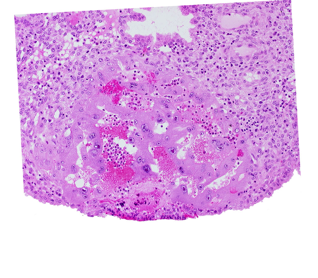endometrial epithelium, endometrial sinusoid, lacunar vascular circle, lumen of endometrial gland, uterine cavity