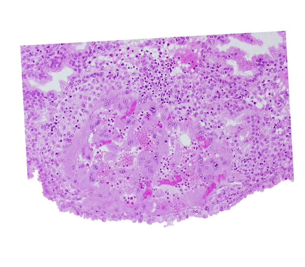 edematous endometrial stroma (decidua), endometrial epithelium, maternal blood cells in trophoblast lacuna, syncytiotrophoblast, uterine cavity
