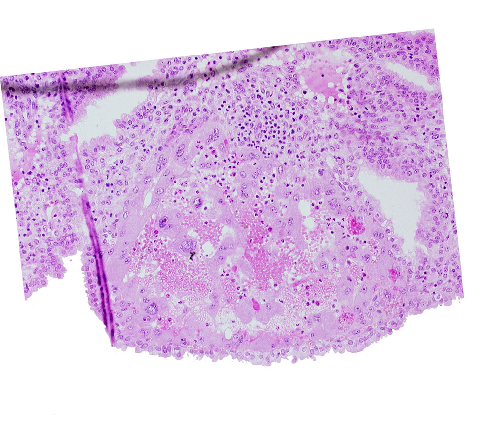 endometrial epithelium, maternal blood cells in trophoblast lacuna, syncytiotrophoblast, syncytiotrophoblast / decidua interface, uterine cavity