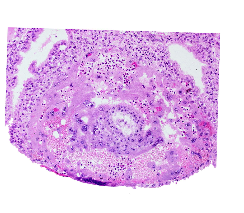 chorionic cavity, disrupted endometrial epithelium, maternal blood cells in trophoblast lacuna, syncytiotrophoblast, uterine cavity