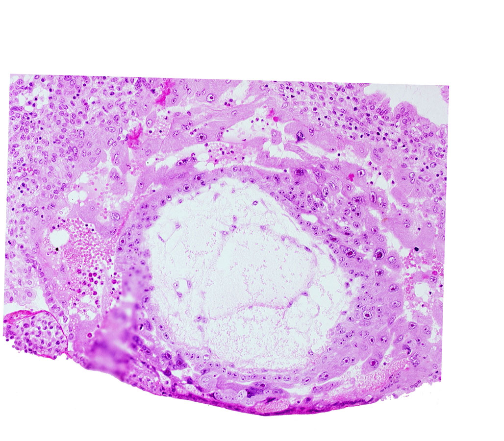 chorionic cavity, extra-embryonic reticulum, lacunar vascular circle
