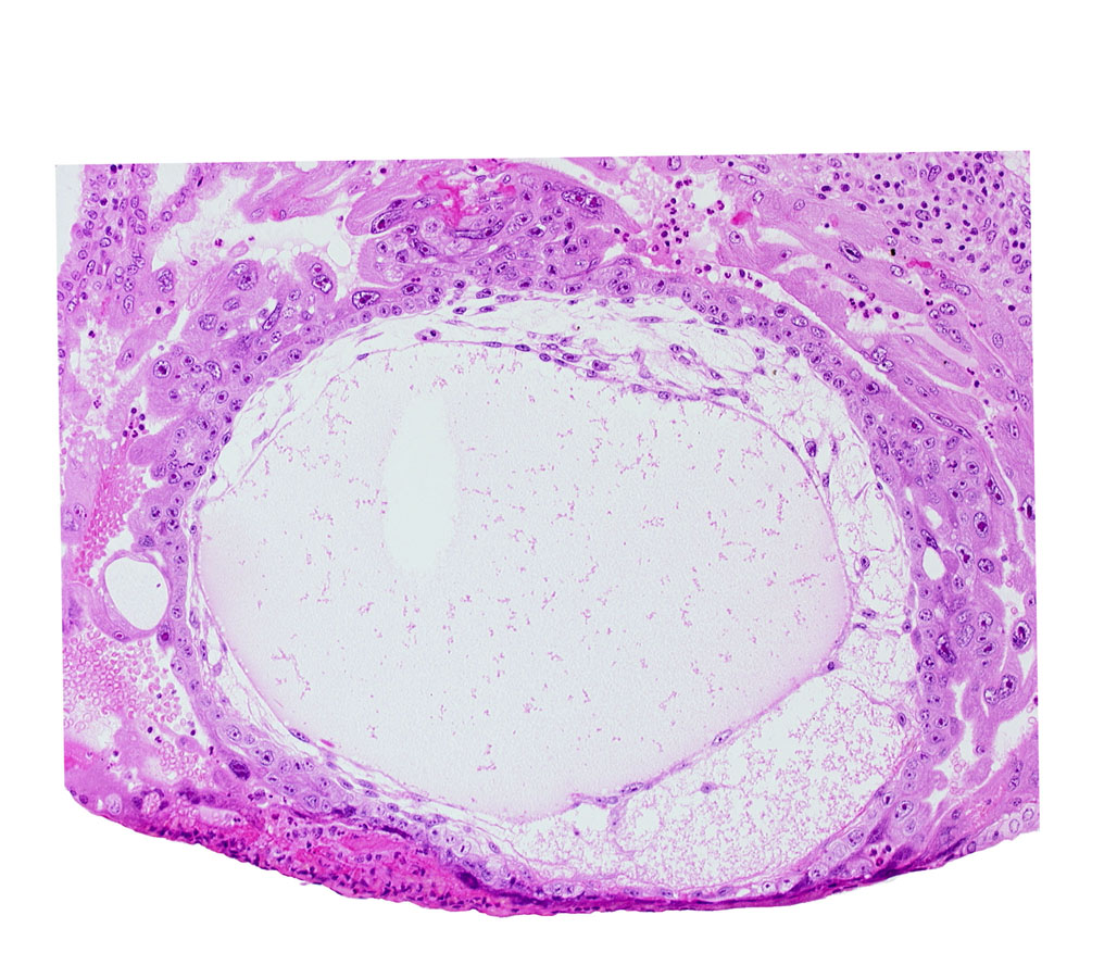 chorion, chorionic cavity, exocoelomic (Heuser's) membrane, primary umbilical vesicle cavity