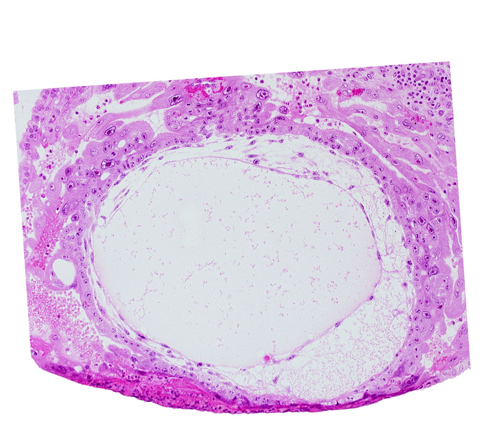 chorionic cavity, exocoelomic (Heuser's) membrane, primary umbilical vesicle cavity, syncytiotrophoblast