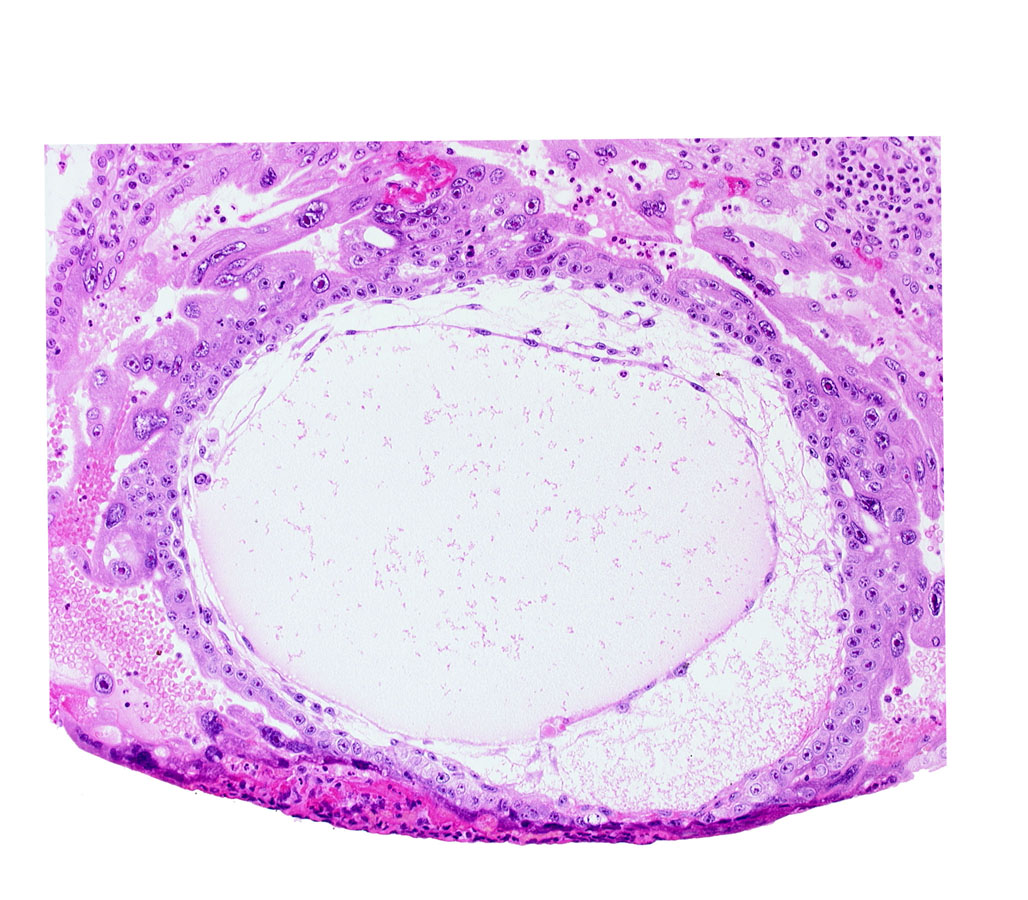 chorionic cavity, cytotrophoblast, primary umbilical vesicle cavity, syncytiotrophoblast, uterine cavity
