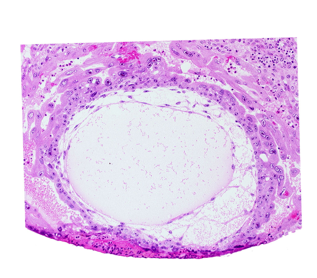 chorionic cavity, cytotrophoblast, lacunar vascular circle, primary umbilical vesicle cavity, syncytiotrophoblast