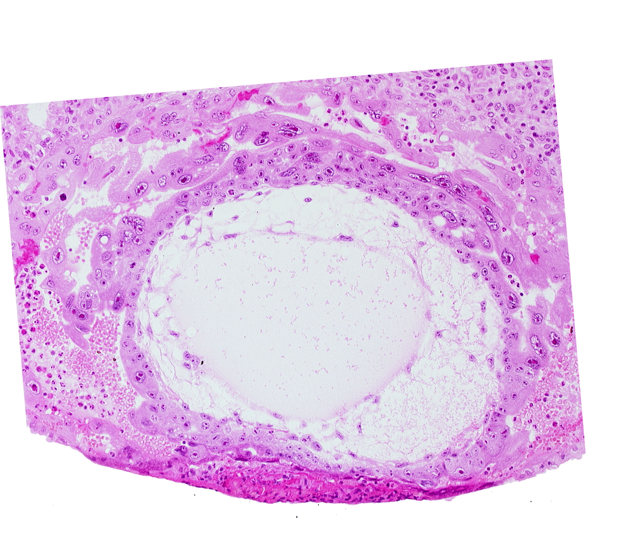 chorionic cavity, definitive exocoelomic (Heuser's) membrane, extra-embryonic mesoblast, primary umbilical vesicle cavity