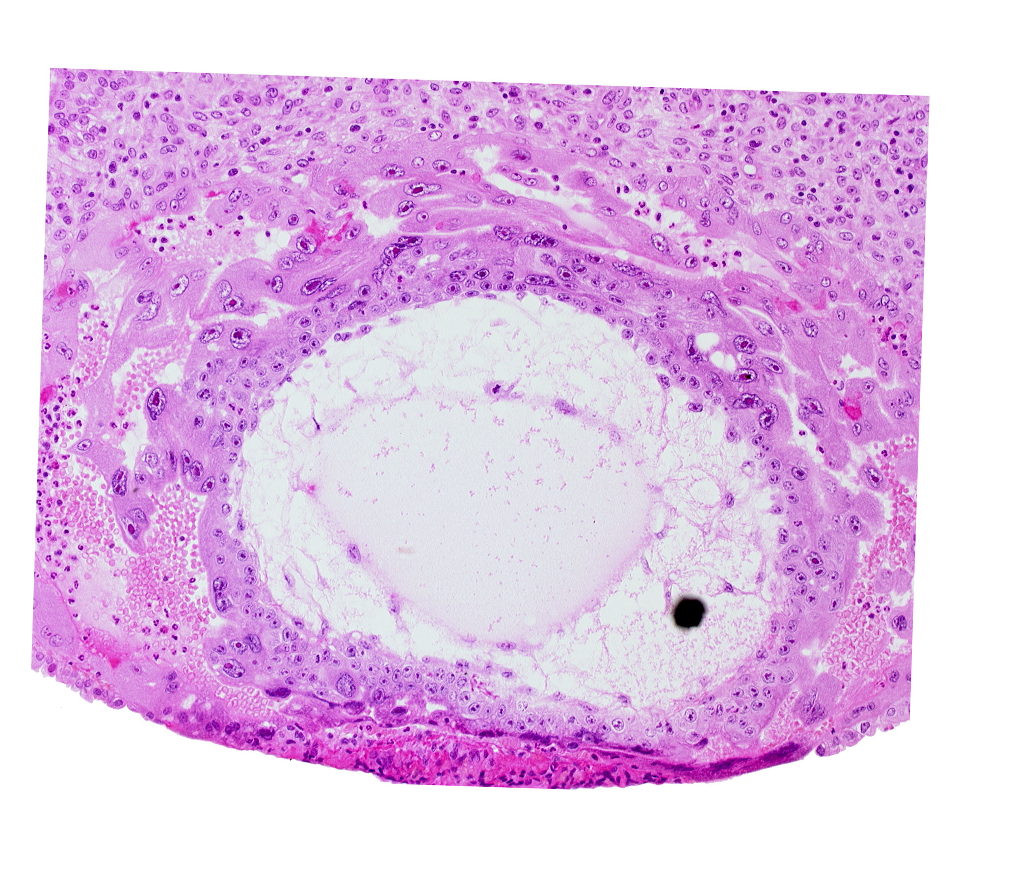 chorionic cavity, definitive exocoelomic (Heuser's) membrane, primary umbilical vesicle cavity