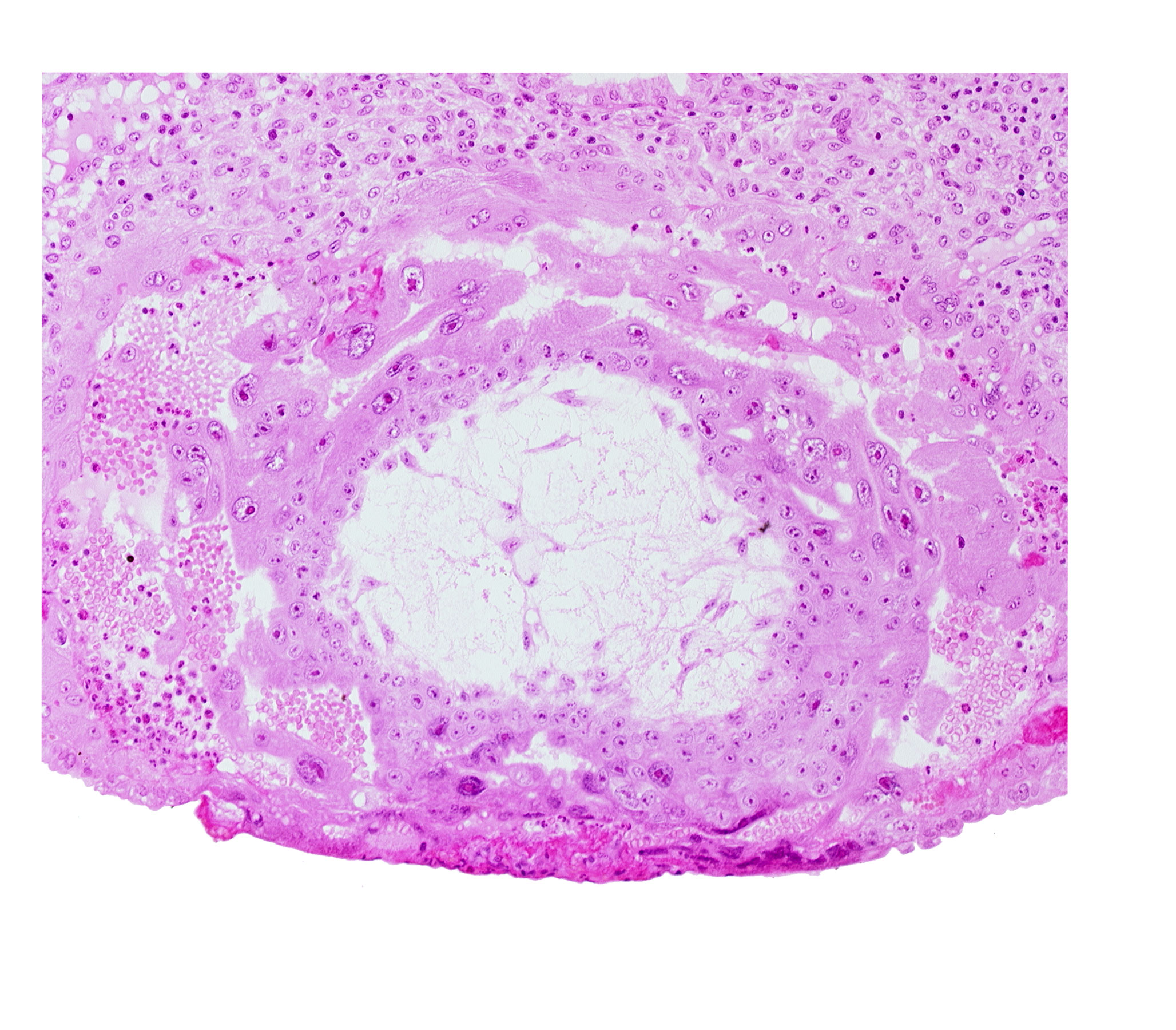 chorionic cavity, extra-embryonic mesoblast, lacunar vascular circle with maternal blood cells, syncytiotrophoblast