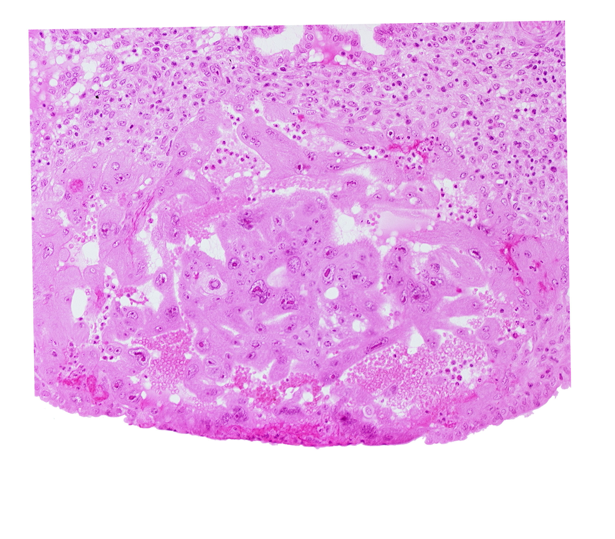 endometrial epithelium, syncytiotrophoblast, uterine cavity